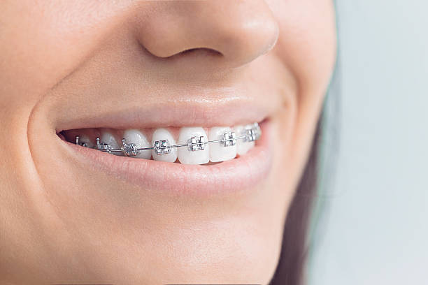 Trusted Safety Harbor, FL Holistic Dental Care Services Experts
